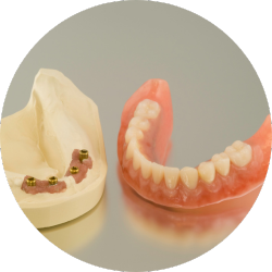 implant denture