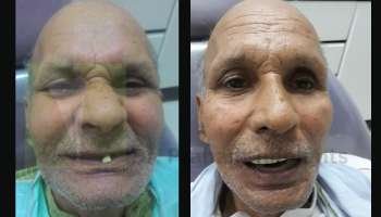 Get Trustworthy Dental Implant Treatment in Gurgaon by Experts at Dr. Prashant Implants at Reasonable Cost
